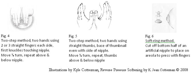 figure 4. 2 step method - two hands using 2 or 3 straight fingers each side. Move one quarter turn, repeat above and below nipple. figure 5. 2 step method, two hands using straight thumbs, base of thumbnail even with side of nipple. Move a quarter tun, repeat, thumbs above and below nipple. figure 6. soft ring method. cut off bottom half of an artificial nipple to place on areola to press with fingers.