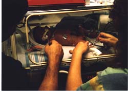 Adam in the transport incubator 5 hours after birth